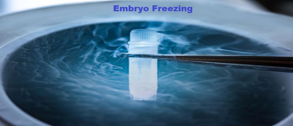 Embryo freezing