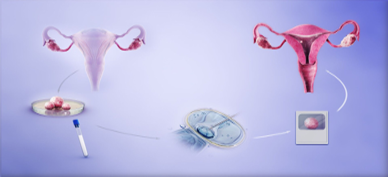 ivf process